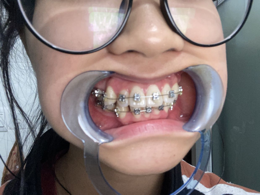 华西医院口腔科医生杨惠的技术和口碑怎么样？获得全国科普图书赛一等奖的专家